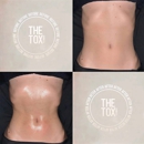 The Tox Allen - Massage Therapists