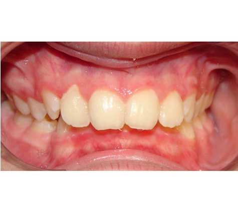Active Orthodontics - Maryborough, QLD