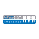ActOn Implants - Implant Dentistry