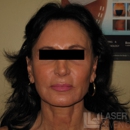 Laser Lipo and Vein Center - Physicians & Surgeons, Laser Surgery