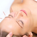 CT Acupuncture Center - Acupuncture