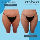 Envision Cosmetic Surgery: Dr. Benjamin Dunkley - Day Spas