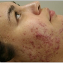 AlecXander Medical Spa - Hair Removal