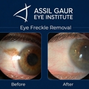 Assil Gaur Eye Institute of Los Angeles - Physicians & Surgeons, Ophthalmology