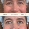 Achieve Esthetics gallery