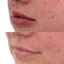 Nakedmd Chula Vista - Skin Care