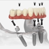 Kent Dental Implant Center gallery