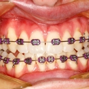 InSmyle Dental - Dentist Chicago - Cosmetic Dentistry
