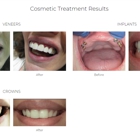 Advanced Dental Center - St. Matthews