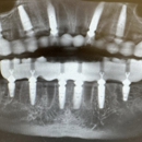 Dakota Implant & Sedation Center - Implant Dentistry