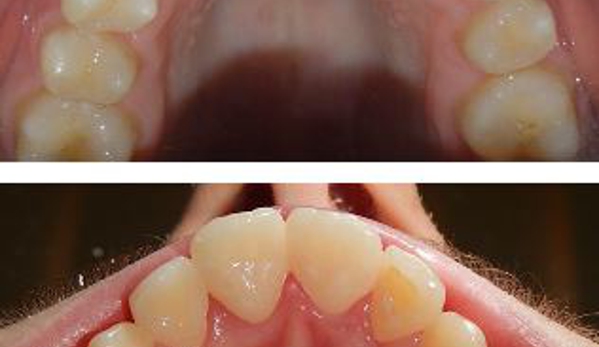Glenn Carty Orthodontist - Gungahlin, ACT