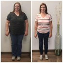 Jupiter Weight Loss - Weight Control Services