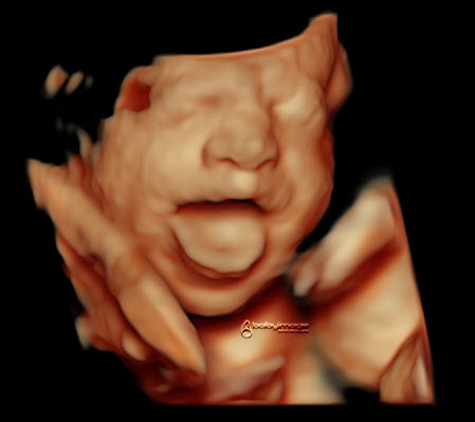 Baby Image 3d 4d Ultrasound - Sugar Land, TX