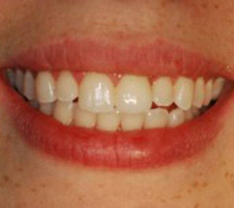 Elite Prosthetic Dentistry: Dr. Gerald M. Marlin - Washington, DC