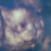 A Miracle to Behold 3d/4d Ultrasound
