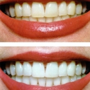 Illuminating Smiles - Teeth Whitening Products & Services