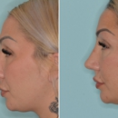 Facial Plastic Surgery Miami - Day Spas