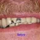 Bright Smile Design Dental - Implant Dentistry