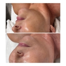 Lesan Esthetics - Wax