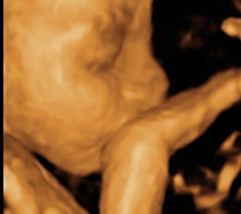 TLC Imaging 3D/4D Ultrasounds - Reynoldsburg, OH