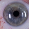 Insight Vision Optometry Las Vegas gallery