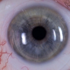 Insight Vision Optometry Las Vegas