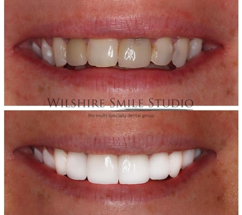 Wilshire Smile Studio - Los Angeles, CA