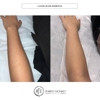Bared Monkey Laser Spa - Long Island City gallery