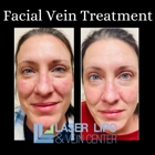 St Louis Laser Vein Center