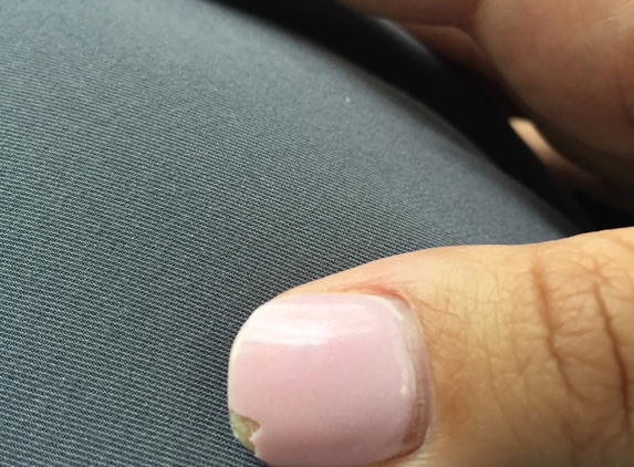 Jj Coco Nail & Spa - Bronx, NY. This is four days after the second time.