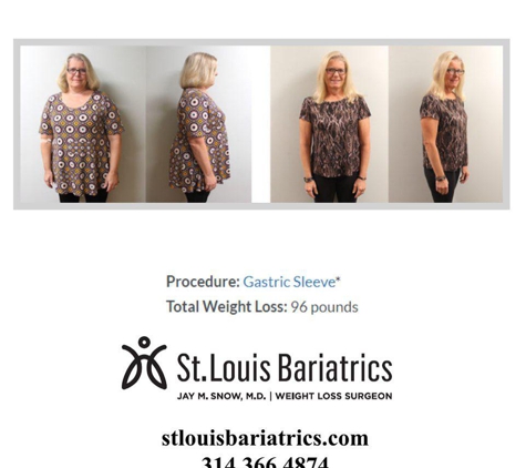 St. Louis Bariatrics: Jay Michael Snow, MD - Festus, MO