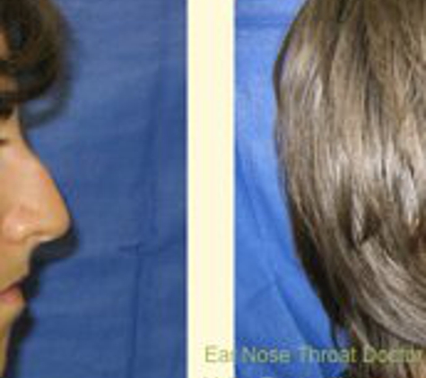 Lamorinda Ent Face & Neck Surgery Inc - Lafayette, CA