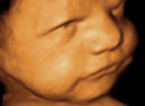 Picture Perfect 3D/4D Ultrasound Imaging - Houston, TX