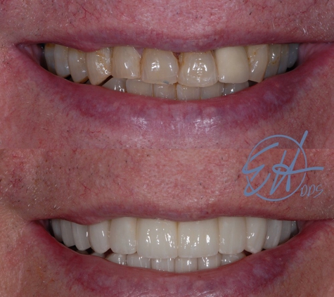 Eric Hull DDS Aesthetic & General Dentistry - Comstock Park, MI