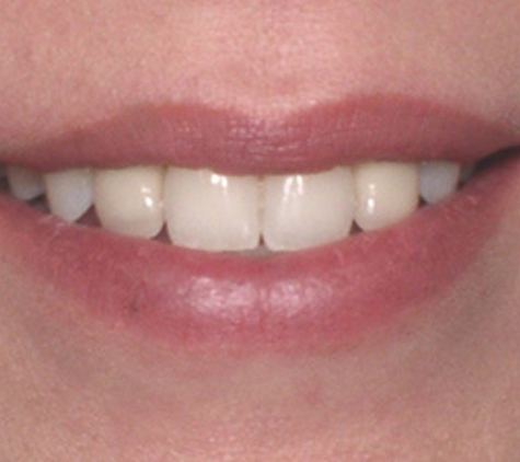 South Texas Dental Implants & Prosthodontics - San Antonio, TX