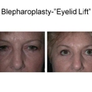 Dr. Joseph T. Chun, MD - Physicians & Surgeons, Cosmetic Surgery
