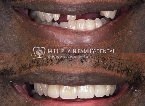 Mill Plain Family Dental - Danbury, CT