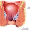 Colonoscopy & Endoscopy Center gallery