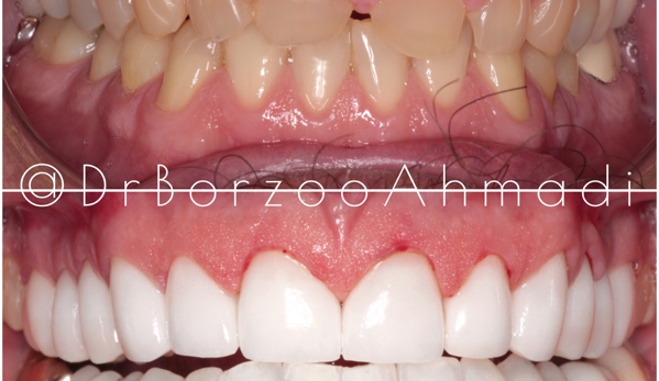 Dr. Borzoo Ahmadi DDS - West Hollywood, CA