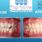 Top Nova Orthodontics