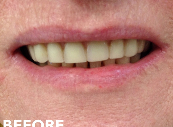 Warrawong Denture Clinic - Warrawong, NSW
