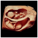 Peekaboo 3D 4D Ultrasound - Medical Labs