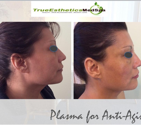 True Esthetics MedSpa - Miramar, FL