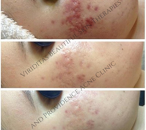 Viriditas Beautiful Skin Therapy & Providence Skin Care - Providence, RI
