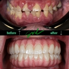 gvd AESTHETICS & REHABILITATION
