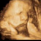 Hello Baby 3D/4D Ultrasound Studio