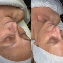 Lume Laser Studio - Clinics
