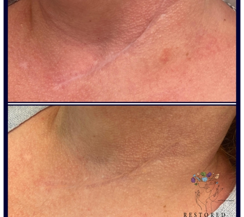 Restored Cosmetics (Medical Tattooing & Permanent Makeup) - Alpharetta, GA