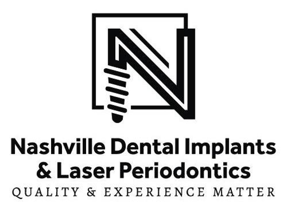 Nashville Dental Implants - Hermitage, TN