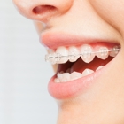 Precision Smile Orthodontics
